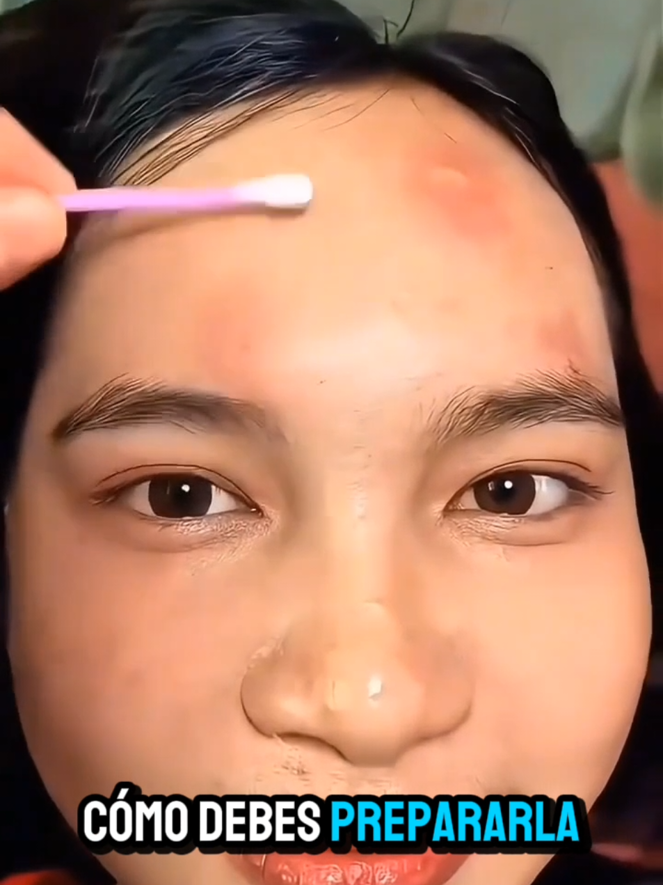 elimina las berrugas de tu rostro #viral?videotiktok😇😇 #paratiiiiiiiiiiiiiiiiiiiiiiiiiiiiiiiiii🦋 #belleza #pielbonita #tendencia #recetassimples #mascarilla #fyp 