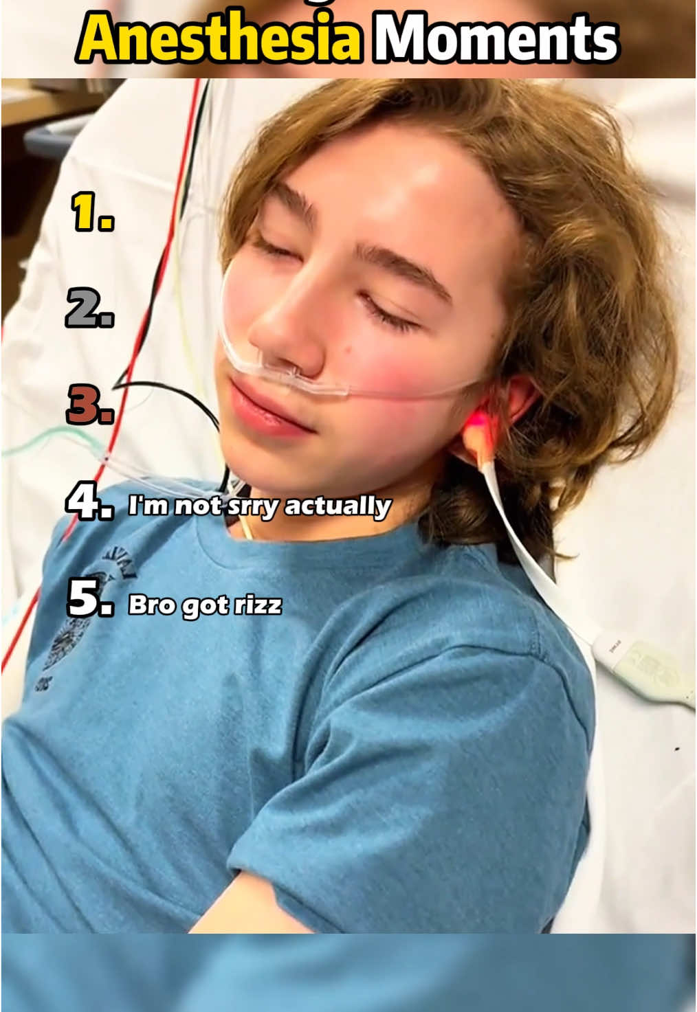 Best Anesthesia moments#anesthesia #ranking #usa🇺🇸 #fyp #funny #fypシ #top5 #top10 