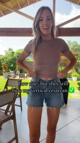 Maybe stick with your normal size unless you got a booty cuz there’s no stretch. #lowriseshorts #edikted #baggyjeanshorts #tiktokshopcreatorpicks 