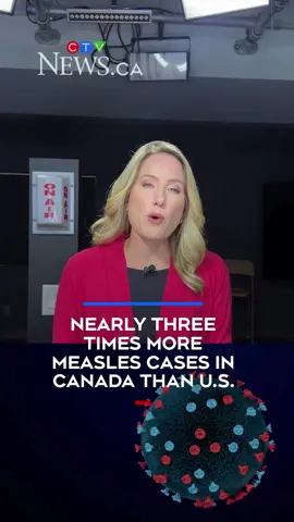 Canada has nearly three times more confirmed measles cases than the United States right now, according to recent public health data. Canada this year has seen a total of 3,822 measles cases, reported in 10 provinces and territories. Data by federal public health officials updated Monday shows 3,517 cases are considered confirmed and 305 are “probable.” One death was reported in Ontario. The latest available data reflects case information collected up until July 5. The Canadian provinces with the most reported cases this year are Ontario at 2,245, Alberta at 1,231 and Manitoba at 138. Government officials didn’t break down which of these cases are confirmed. The data is “likely an underestimate” of the total in Canada, the federal government wrote on its website, noting it only represents reported cases and that there is a “small reporting delay.” Meanwhile in the U.S., a total of 1,309 confirmed measles cases were reported in 40 states, according to the latest numbers posted on the U.S. Centers for Disease Control and Prevention website Tuesday. It didn’t provide the number for probable cases. Three people have died this year in the U.S. due to measles, the CDC says. #ctvnews #news