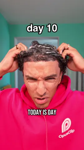 Hair regrowth journey 🤯 #viral #fyp #gunther #curlyhair 