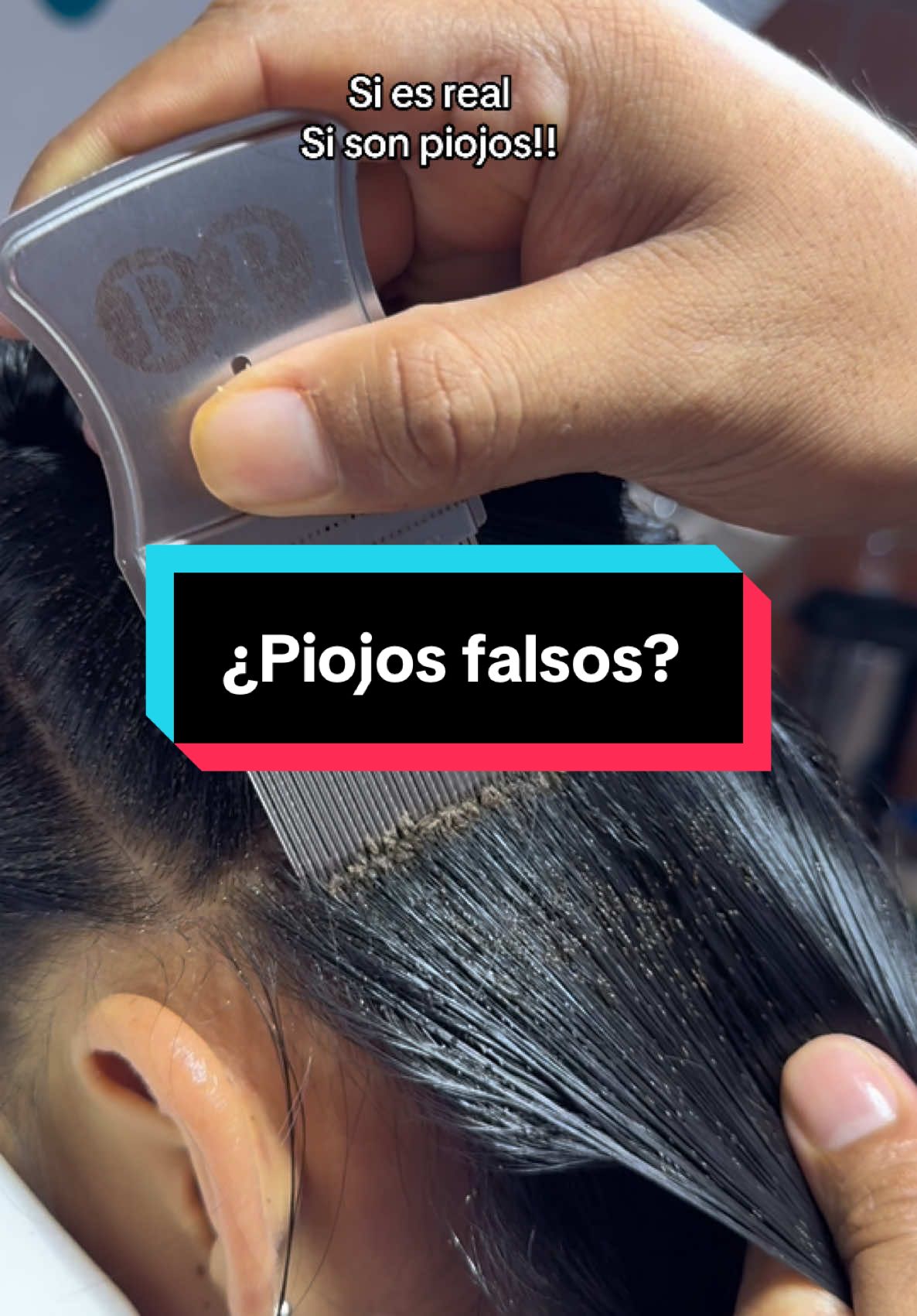Si son piojos reales!!!  #piojos #piojosyliendres #liendre #piojostiktok #xalapa #liendre #puebla #lice #nits #pediculosis #cdmx 