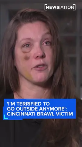 A woman injured in the viral Cincinnati brawl sits down exclusively with NewsNation’s Rich McHugh to recount the night of the brutal assault. “I’m terrified to go outside,” she says. “We are victims, and I know I did nothing wrong other than trying to help someone.” MORE: https://www.newsnationnow.com/us-news/midwest/cincinnati-brawl-victim-holly-injuries/ 