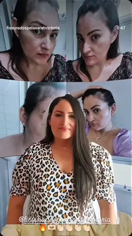 @Quitéria 