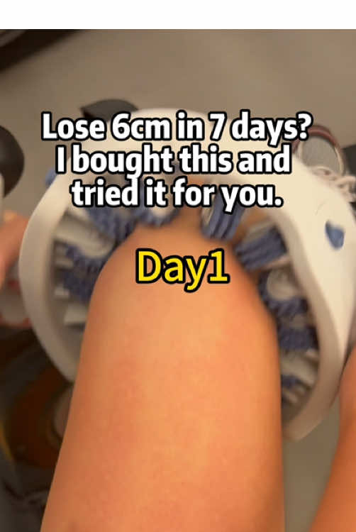 I bought the anti-cellulite roller that’s been very popular recently and tried it out for everyone. I used it for 7 days and the results were remarkable!!!#lymphaticdrainage #tiktokmadembuyit #sculptingtool #wellnesstok #draintok #usa #selfcareriuals #cellulite #sprots #tiktokshop #legworkout #soulyis #celluliteroller 