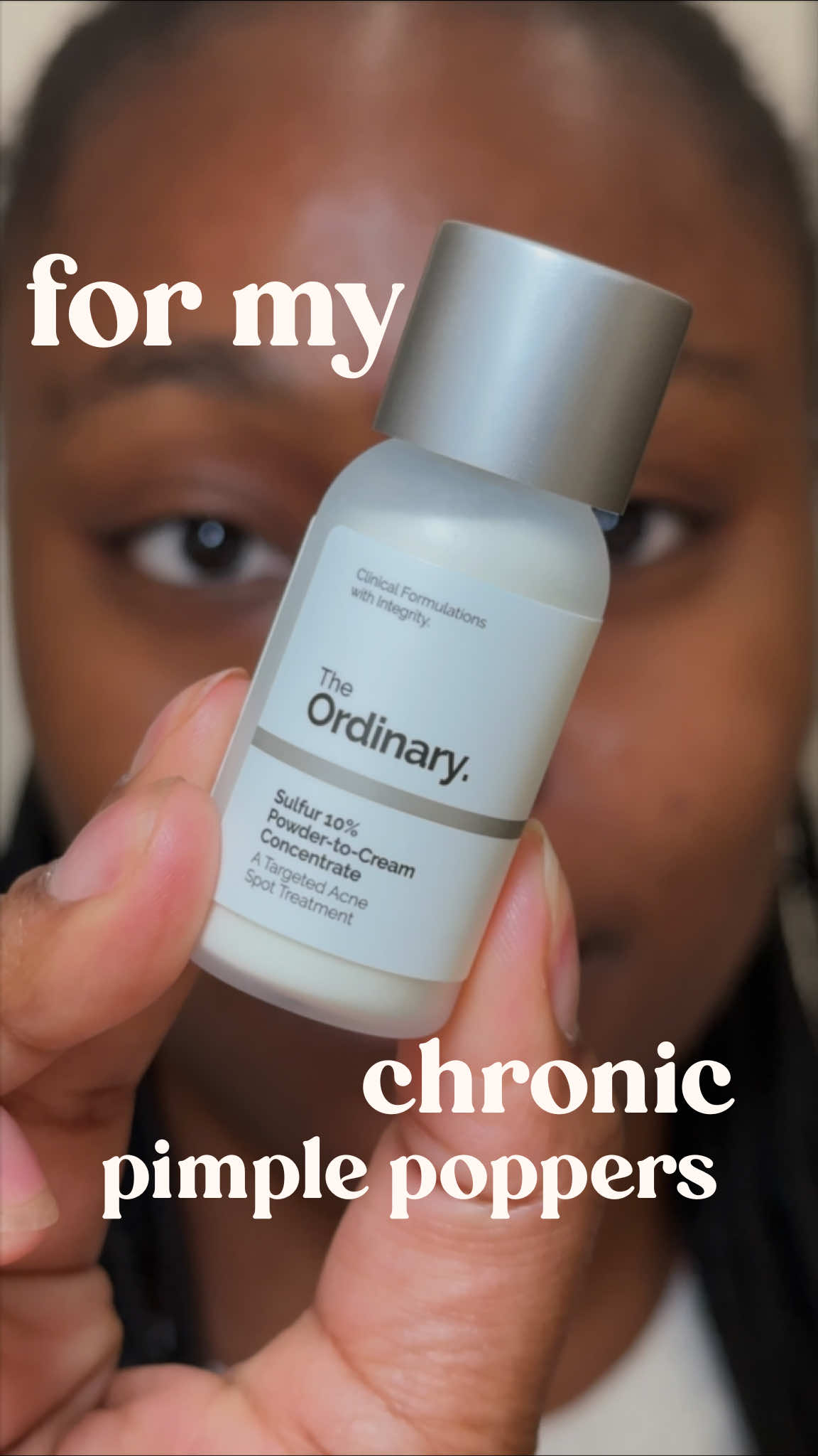 #ad | Stop popping your pimples 🚫✨ As an esthetician, I always recommend sulfur for breakouts because it helps reduce spots fast and is gentle enough for sensitive skin. @The Ordinary Sulfur 10% Powder-to-Cream Concentrate controls oil, unclogs pores, and is way more sustainable than pimple patches. You can grab it @sephora 🛍️ #sephora #theordinary
