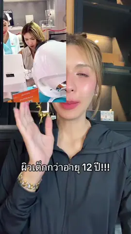 #skintific #เซรั่มวิตซี #vitaminc #หน้าใส #ttsร้านใหม่ลดแรง #รีวิวบิวตี้ #tiktoklooks 