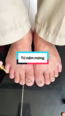 Trả lời @Mơ Tây Ninh Mẹ Bé Kun ai đang gặp cái tình trạng về móng thì tham khảo nha #nammong #nammongtaychan #trinammong 
