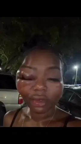 #southafrica#tiktoktrending #funnyvideo #everyone #jokess 🤣🤣🤣