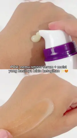nagih banget pakai retinol serum dan moist ini setelah liat hasilnya GONG banget 💋😍 #YOUrSkinRefinement #YOUSkincare #YOUROWNUNIQUE 