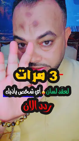 3 مرات لعقد لسان 😝 أي شخص يأذيك #دعاء #الدعاء #الدعاء_المستجاب #الدعاء_يغير_القدر #قرآن #قرآن_كريم #قرآن_كريم #وصفة_سحرية #نفحات #حلمى_السيد #طاقة #طاقة_ايجابية_🔋🤝  #تنمية_بشرية 
