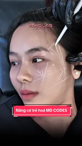 Nâng cơ tức thì bằng phương pháp Md Codes #madlab #huynhvanfiiler 