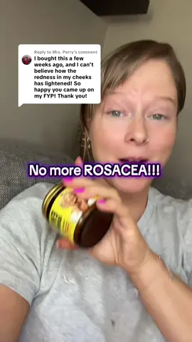 Replying to @Mrs. Perry SO HAPPY! #skincareroutine #moisturizer #naturalskincare #dryskin #rosacea #skincare #beautyhacks 