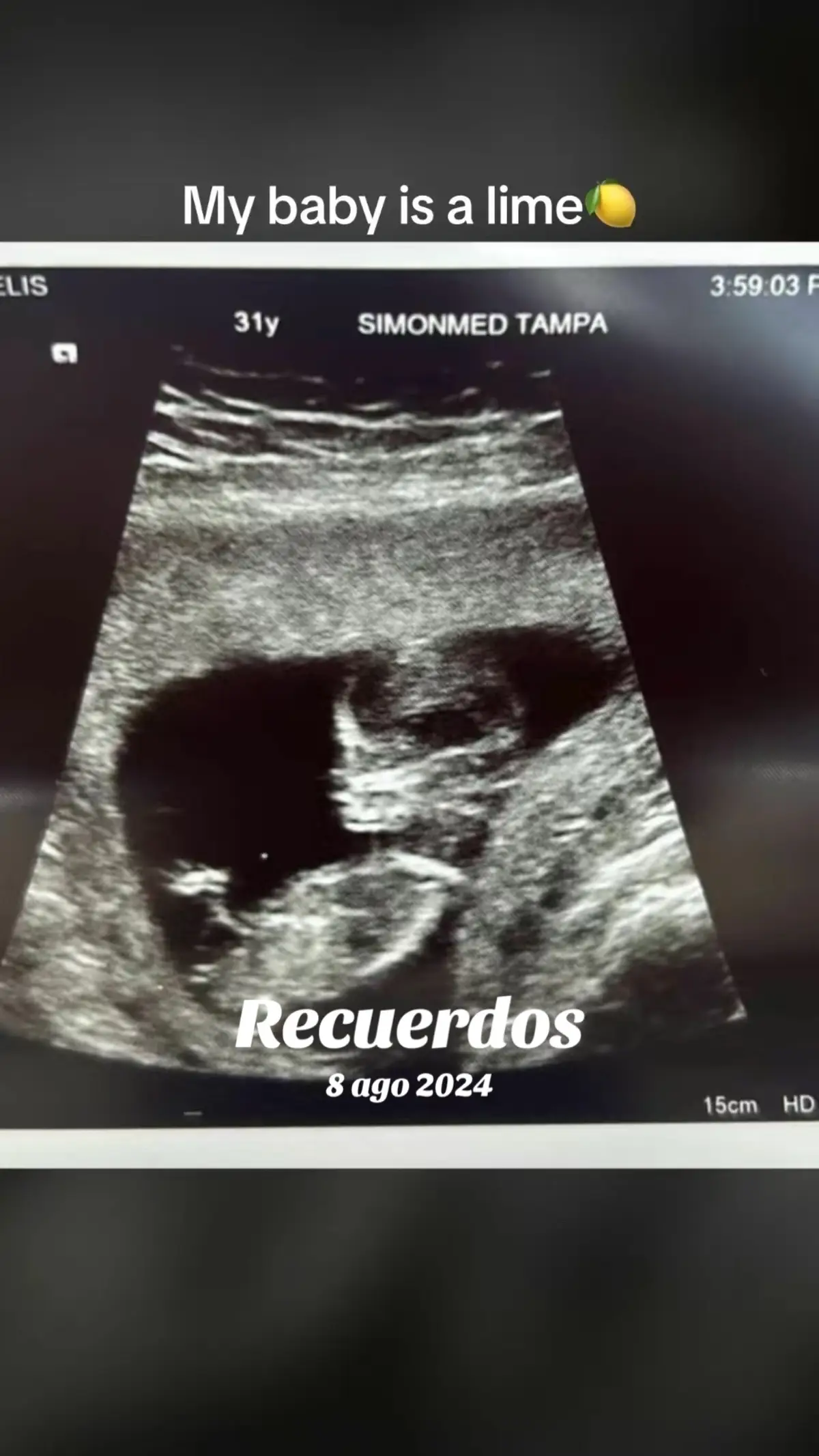 #recuerdos 