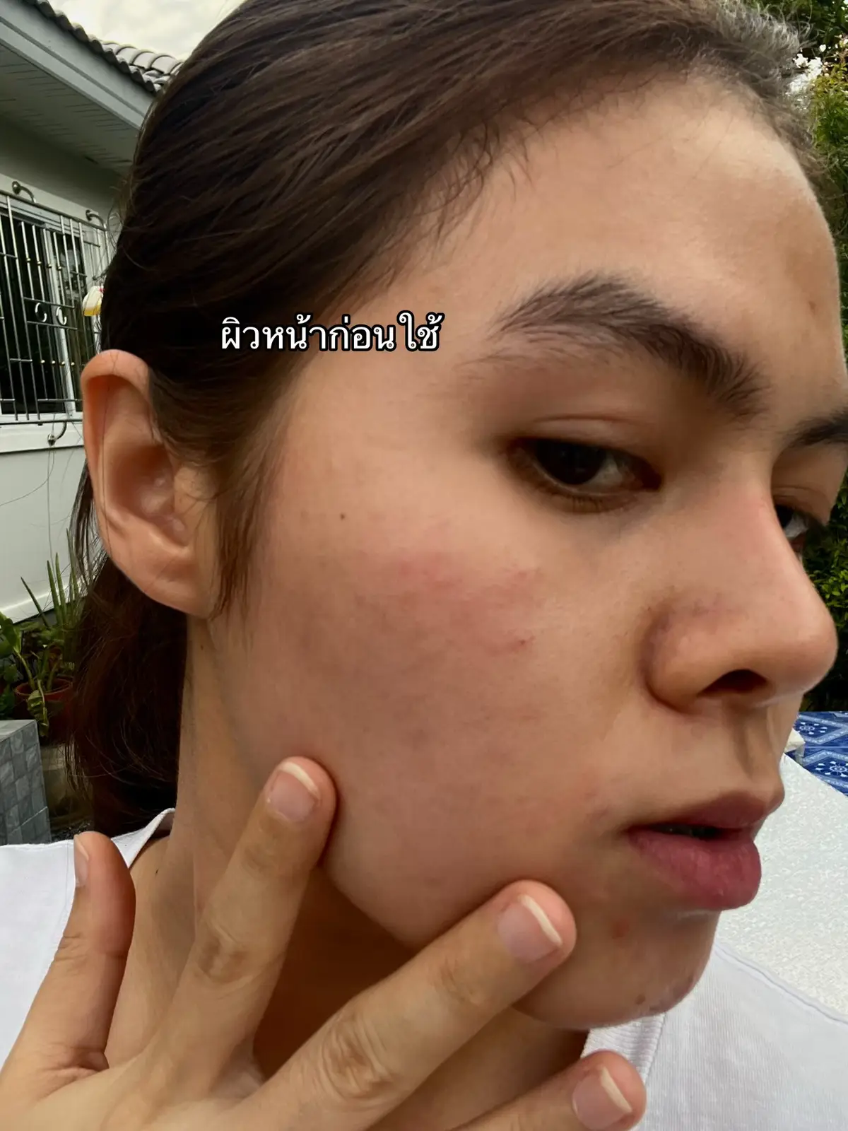 #ครีมน้ำนมข้าว #ครีมน้ำนมข้าวสุรนุช #ครีมลดสิว #skincare #ฟีดดดシ 