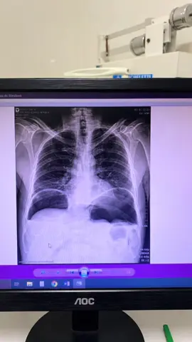 Residência de cirurgia geral 😂🥹 #fy #cirurgia #medicina #residencia #rotina 