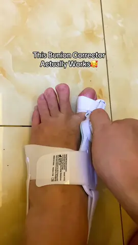 🔥This is the best bunion corrector I’ve ever used, made with excellent fabric, comfortable to wear, and it truly works! #olebrandselect #bunionrelief #bunioncorrector #footcare #tiktokmademebuyit #tiktokshopbacktoschool #gadget #fyp 