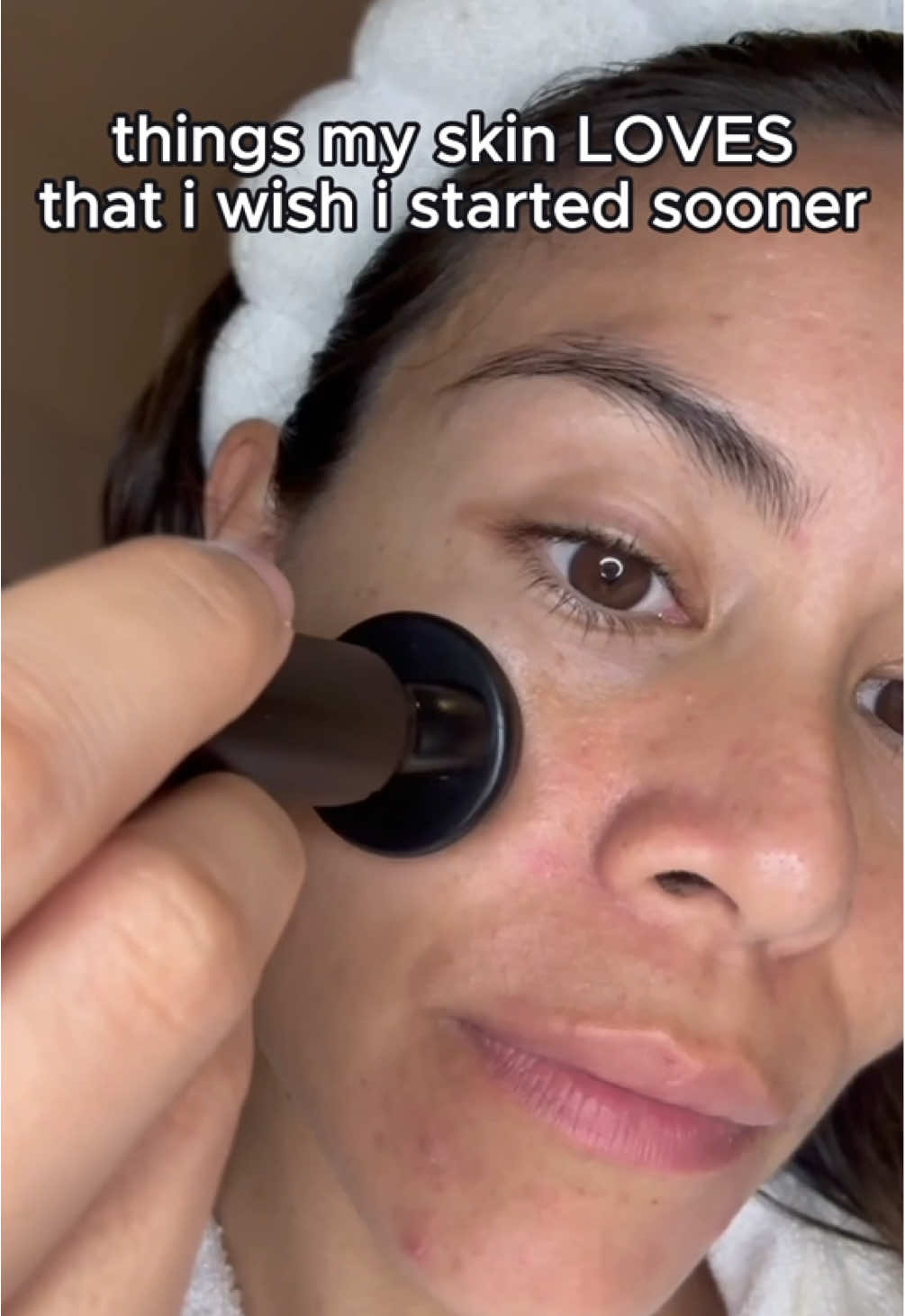 #acnescars #acnescartreatment #acnecommunity #skincarecommunity 