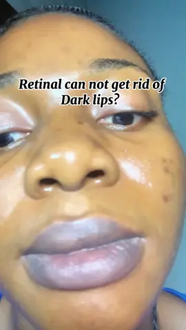 Dark lips were? Retinal is the holy grail 🥰#KSECERTGlowChallange #KSECERT #Seoul1988 #Retinal @KSECRET GLOBAL 