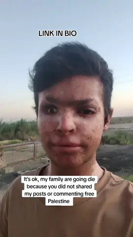 Comment and share to help my family get help …🙏 Link in biography . Every contribution, no matter how small, makes a difference. May Allah reward you all 🙏 #islamic_video #palestine #gaza #subhanallah #alhamdulillah #fyp #trendingvideo #trendingsong #uae🇦🇪 #saudiarabia 