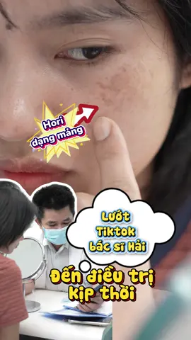 Hori nám chân sâu dạng mảng 🥰🥰🥰#reels #xuhuong #bshainguyen #lỗ_chân_lông_to #nám #nám_chân_sâu #tàn_nhang 