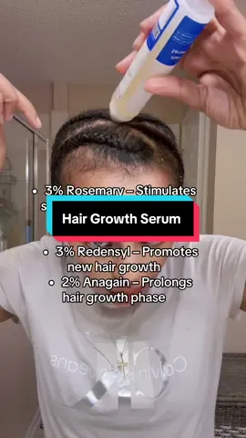 Stronger, fuller, healthier hair starts here 🌿✨ Bodywise Advanced Hair Growth Serum combines 3% Rosemary, 2% Aminexil, 3% Redensyl & 2% Anagain to nourish your scalp and boost growth from the root! 💆🏽‍♀️💖 #Hairgrowthoil  #hairgrowthjourney #hairgrowthtips  #hannarobinson #ethiopian_tik_tok 