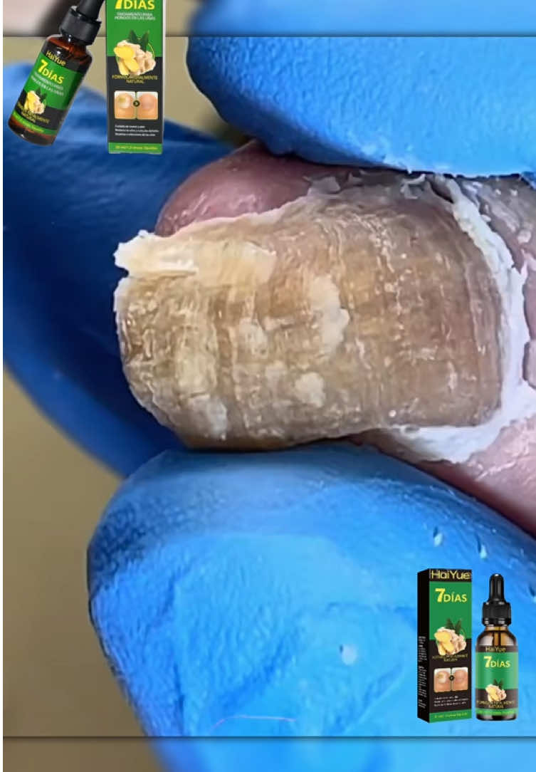¡Tus uñas merecen un mejor cuidado!#JengibreParaUñas #Vitamina #Onicomicosis #HAIYUE #Uñas #reparación #VitaminaB #CuidadoDeUñas 