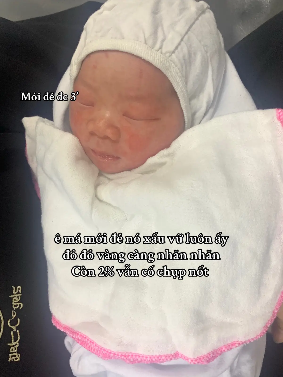 lớn đưa ảnh k thèm nhận mặt #xh #fyp #xhtiktok #4u #Love #viral #summertimes #ideas #cute #baby 