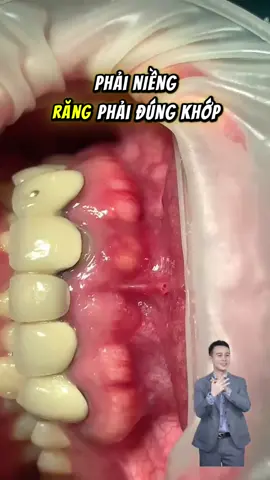 Niềng răng thì cứ bảo không thích tốn thời gian...#bacthanhchuatuy #baotontuyrang 