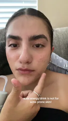 fun fact alani has b12, not good for acne prone skin 🤯 #alani #acneskin #acnejourney 