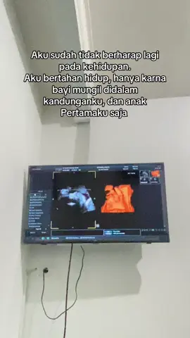 Maafin mama ya sayang, mama masih suka sedih dan kamu harus ikut merasakannya🥹 tumbuh sehat dan sempurna ya adik sampai waktu itu tiba pertemukan kita, kamu dan kaka mu adalah alasan mama harus tetap kuat 👶🏻🤲🏻🤍😇 #anakpertama #anakkedua #bumil #masyaallahtabarakkallah #fypシ゚ 