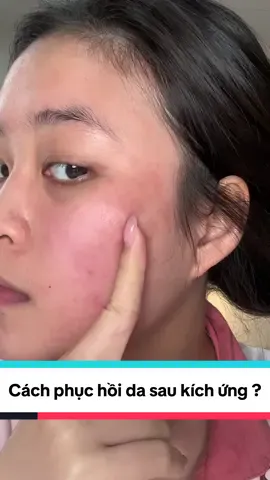 Cách phục hồi da sau kích ứng , mẩ.n đỏ ? 🤔🥹😬#rinavaseoul #skincare #lamdep #beauty #trending #Cicaplast #larocheposaypartner #depdachieu #trend #viral #skincaretips 