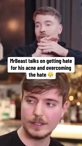 MrBeast is talking straight facts #mrbeast #viral #fyp 
