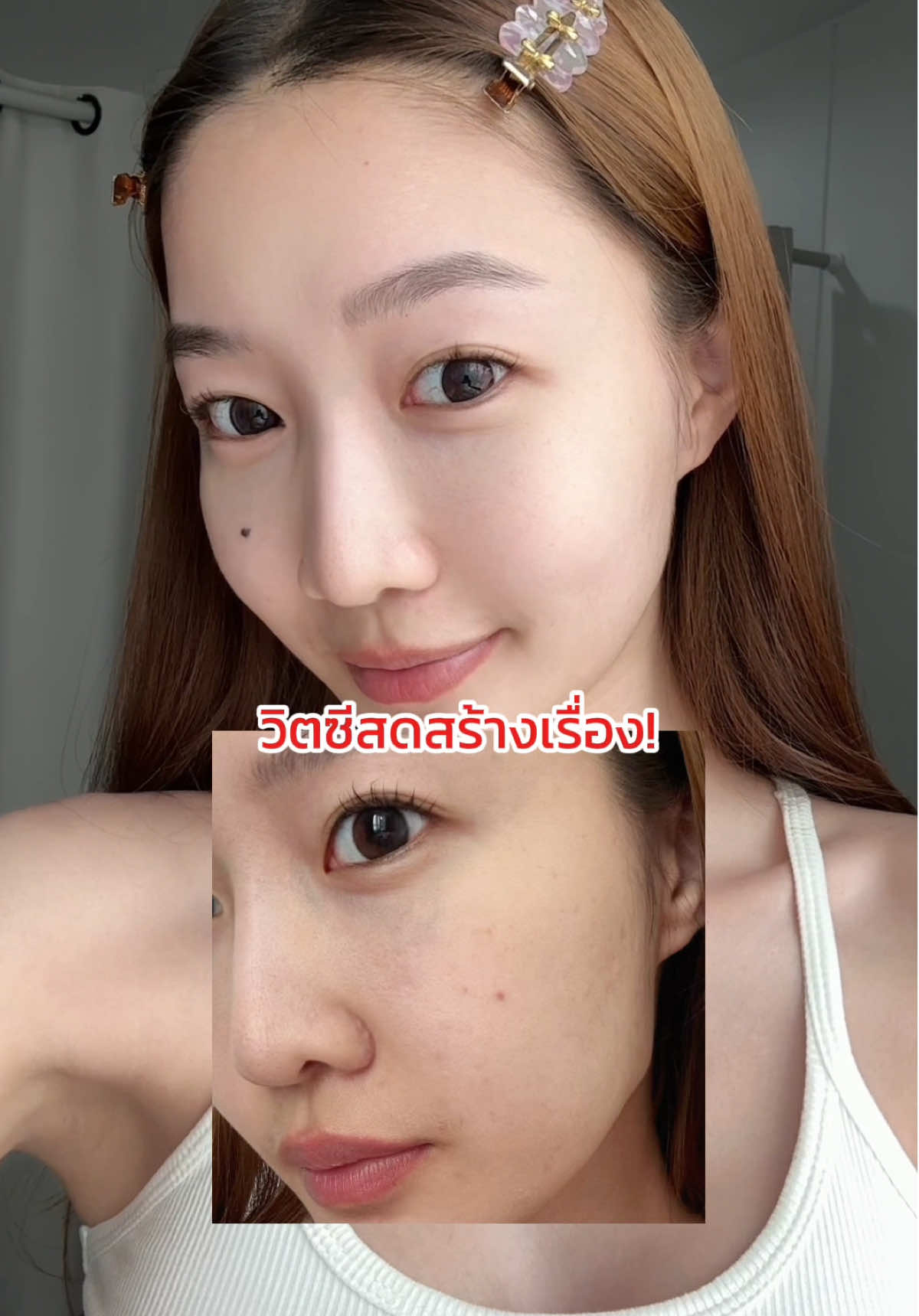 ลูกรักสุดๆเลยตอนนี้😍  #วิตซีเชค #SKINTIFICPureVitC #เซรั่มวิตซีเฟรช #สกินแคร์ #รอยสิว 