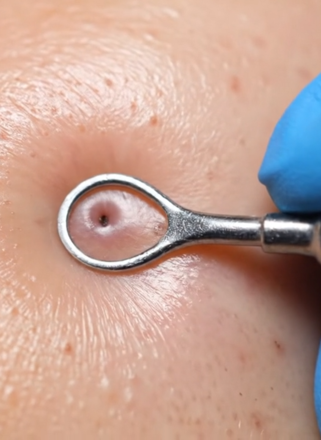 ASMR video #asmr #asmrsounds #asmrvideo #fruitcuttingvideo #asmrcuttingfruits #asmrscooping #blackheadsremoval 