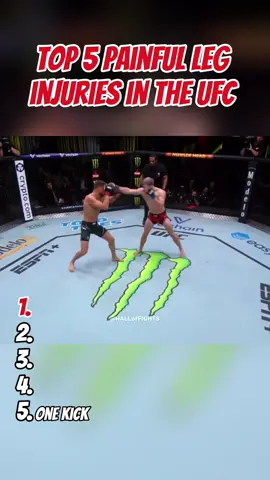 The most painful and shocking leg injuries in the UFC #andersonsilva #chrisweidman #UFC #mma #edsonbarboza #arnoldallen #calvinkattar #injury #painful 