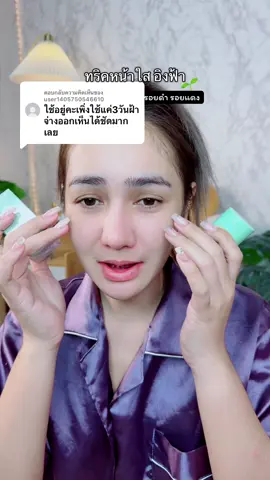 ตอบกลับ @user1405750546610 ทริคหน้าใส อิงฟ้า เริ่ดเนาะ #มาร์คหน้าใส #มาร์คหน้า #หน้าใส #หน้าใสไร้สิว #รีวิวบิวตี้ 