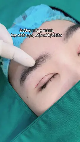 Mí làm 1 bên #treocungchanmay #cắtmíđẹp #nhấnmí #nangmuicautruc #catmoi #málumđôngtien #cắtmídưới #málumđôngtien #tik_tok #viral 