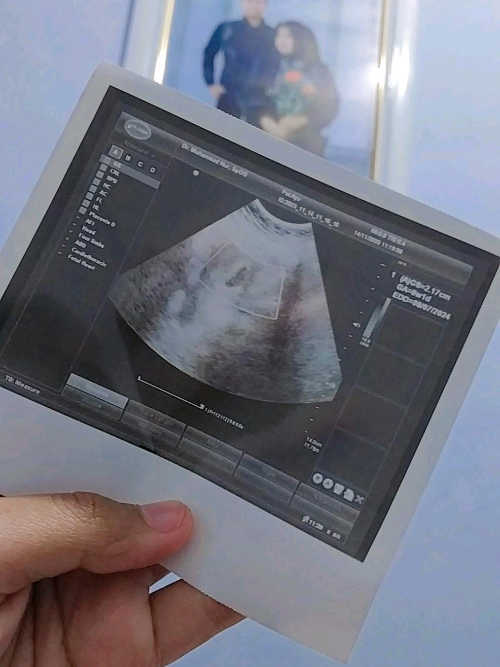 Sehat selalu sayang 💕 #garisdua #pejuanggarisdua #hamil #bocil #anakbayi #promil #promilalami #promilberhasil #kesayangan #affiliatemarketing #affiliate #affiliatetiktok #affiliatepemula #fyp #fyppppppppppppppppppppppp #fypage #fypp #fypシ゚ 