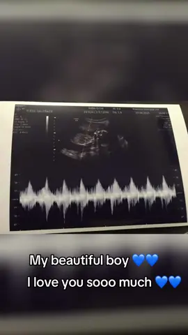 🦋💙💙#fyp #son #foryoupage❤️❤️ #myeverything 