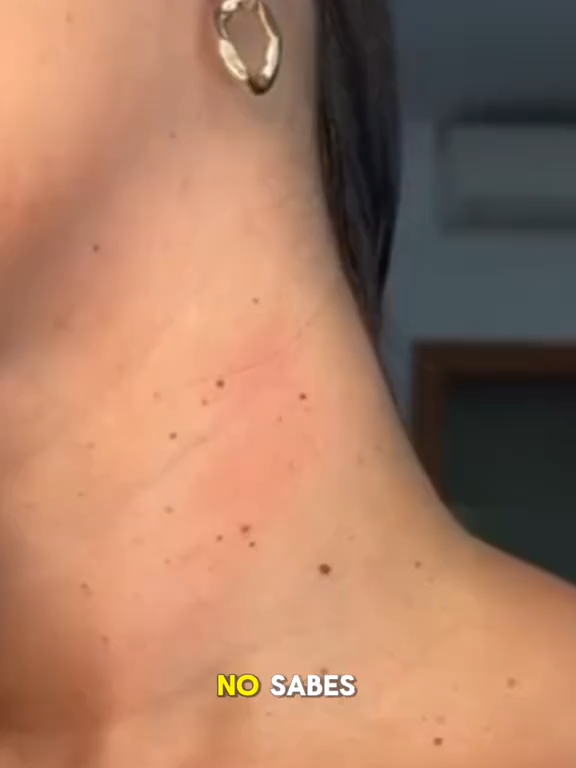 ⚡ ¡Últimas unidades! Nuestra crema quita verrugas actúa rápido y eficaz, dejando tu piel lisa y sin marcas. No dejes que esas imperfecciones te acompañen más tiempo… ¡Aprovecha antes de que se agote! 🖤✨