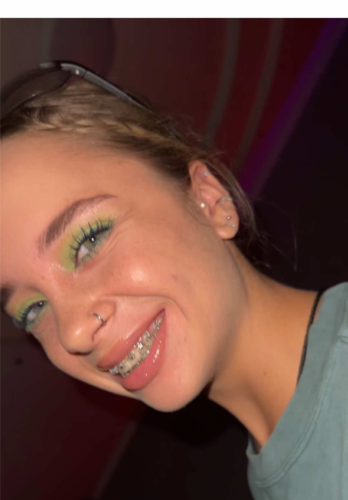 💚