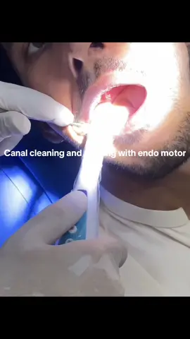 RCT with Endomotor #creatorsearchinsights #tiktokteamunfreezmyacount😥🙏 #viral #viral #tiktokviewproblem🥺😭 #tiktokviewproblem🥺😭 