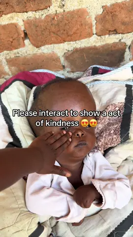 Even 1$ counts 🙏 #donate #headsurgery #homelesskids #orphan #hungry #disability @Selena Gomez @Taylor Swift @Khabane lame @Kylie Jenner 