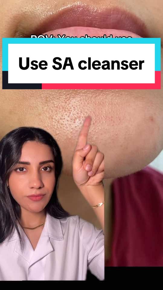 Salicylic Acid works to exfoliate dead skin cells and unclog pores. It also controls excess sebum (oil) production, and keeps pores clear. #blackhead #whiteheads #cloggedpores