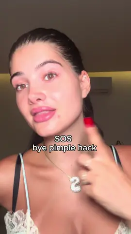 my secret SOS pimple hack when I touch or pop a pimple 🥹✨ #hack #pimple #acne #skincaretips #acnefighter