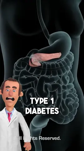 What is type 1 diabetes? follow Dr. Pickle for MORE ‼️ #doctor #health