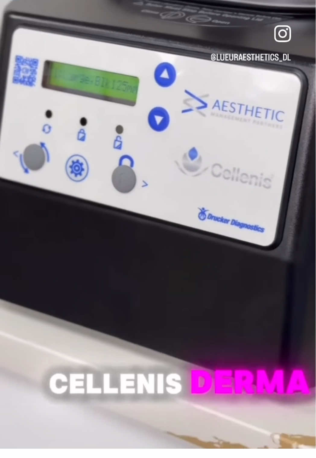 I had the pleasure of injecting a collegue with my favorite regenerative filler… Cellenis Derma PRP! We did under eyes for a little pop and brightening, temples for the “peanut head” that can start happening with aging, chin shadows, and marrionettes.  Cellenis DermaPRP harnesses your body’s own regenerative power to stimulate collagen and elastin... turning back time... slowing down the results of the natural aging process. It not only provides instant volume, but also provides continuous collagen and elastin stimulation. Improving the overall dermal health and infrastructure. Bonus... you get an instant Glow! It is PERFECT for the tricky, delicate under eye area where we often see adverse effects from using traditional HA fillers because most people are not truly candidates for under eye filler. @aestheticmanagementpartners Two treatments are recommended for longevity of 9-12 months and then maintenance like anything else! Lueur Aesthetics 1822 Drew St, Suite 105 352-872-2571 #lueuraesthetics #clearwaterflorida #dunedinflorida #dunedinfl #palmharbor #palmharborfl #safetyharbor #safetyharborfl #cellenisdermaprp #cellenisderma #biofiller #naturalresults #teartroughfillerresul #teartroughfilleralternative #nomorebagsundereyes #refreshed #nomoredarkcircles #undereyebags #undereyecircles #aestheticmanagementpartners#templefiller #nasolabialfolds @user8092919196919 @Aesthetic_cowboy @Inked_Aesthetic_Patriot @Katie Sanders 