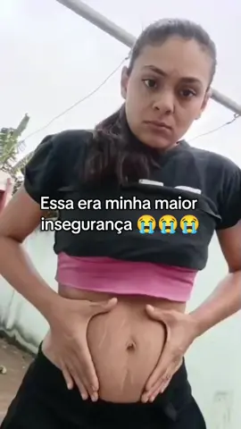 Obrigada creme rosa 🩷#estrias #estriasbrancas #flacidez 