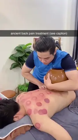 Cupping helps your muscles feel better and less tight. It can make pain go away faster. It also helps your body relax and feel calm. 😌😮‍💨 (via longkyasmr/yt) #foryou #relax #relief 